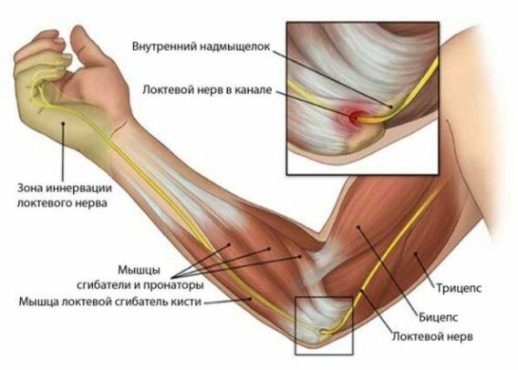 Лікування тендиніту в Миколаєві - фото 2