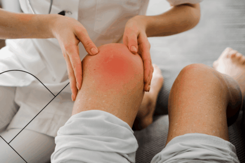 Хондропротектори: кому і коли вони реально допомагають