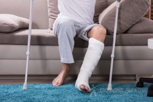 Реабілітація після перелому: навіщо вона, якщо вже «зрослось»