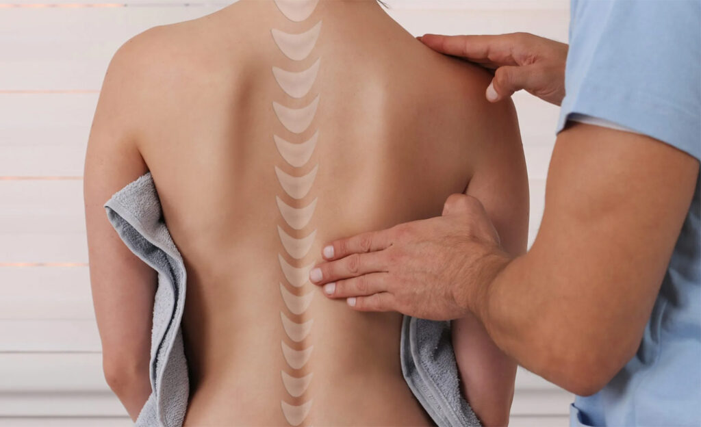 Лікування сколіозу у дорослих: комплексний підхід