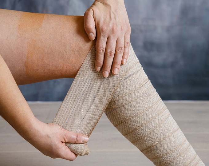 Що таке тромбоз глибоких вен і коли це небезпечно