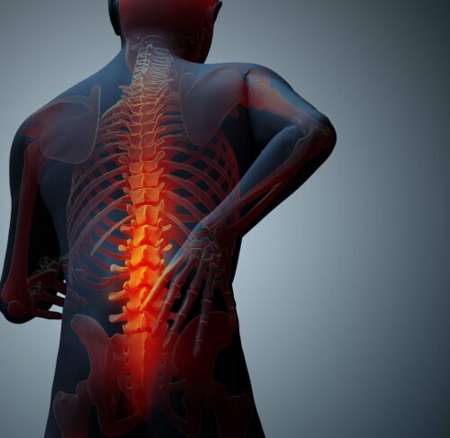 Міофасціальний больовий синдром і ботокс — в чому ключовий ефект