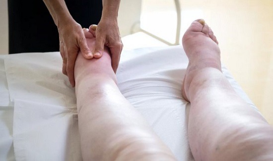 Коли лімфодренажний масаж при лімфостазі корисний, а коли — шкідливий?