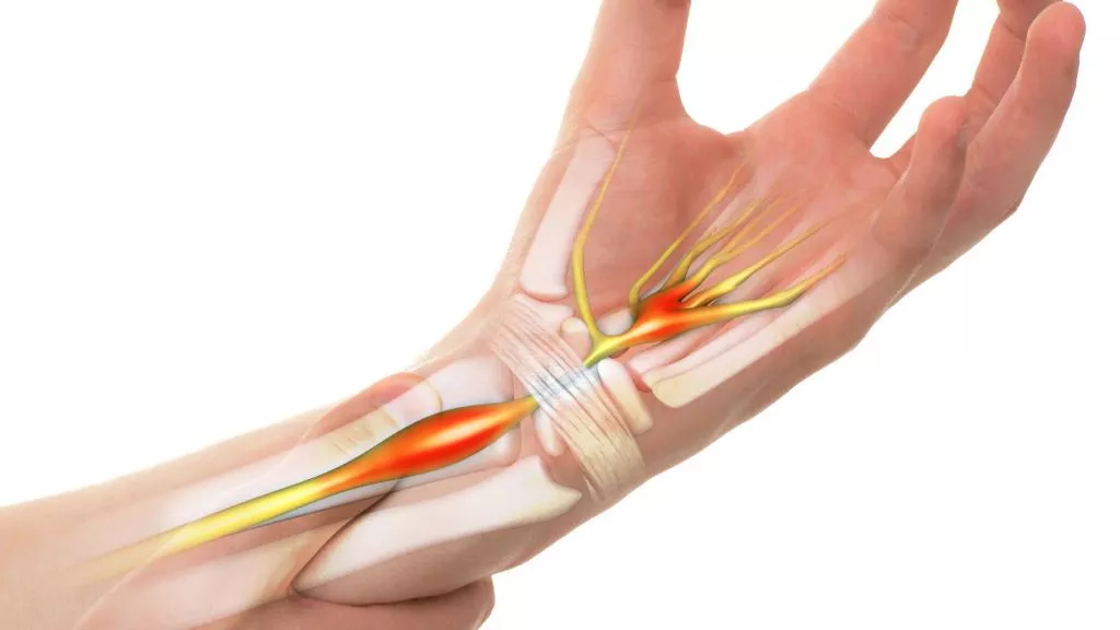 Чому у водіїв часто з’являється синдром зап’ястного каналу?