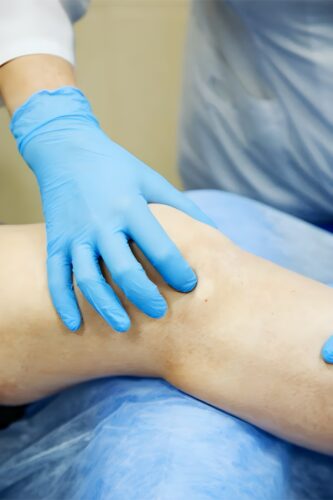 Лікування артрозу без операції: чи це реально?