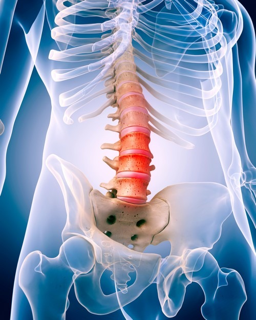 Грижа міжхребцевого диска: операція чи реабілітація? Грижа міжхребцевого диска: операція чи реабілітація?
