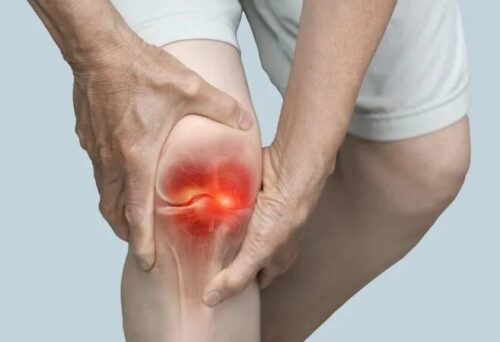 Лечение артроза без операции: реально ли это