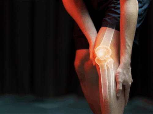 Чому хрустять коліна і коли варто звернутись до лікаря? 