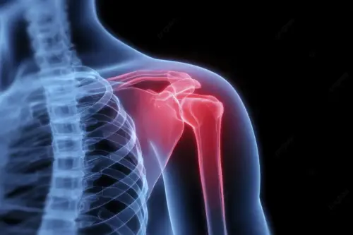 Пошкодження зв’язок плеча: як відновлюють рух і силу?