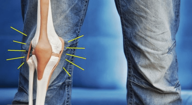 Чому хрустять коліна і коли варто звернутись до лікаря? 