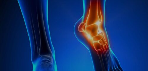 Синовіт: що це таке і чому його не можна запускати?