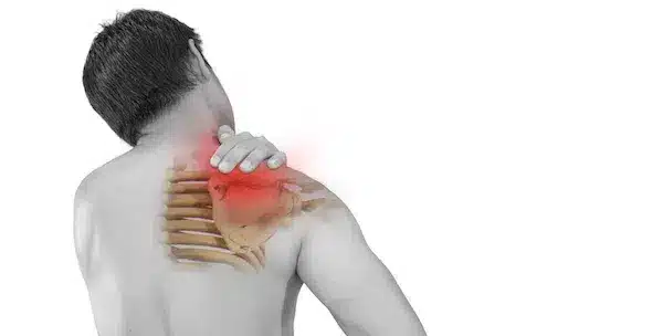 Синдром грудного виходу: коли болить шия, плече і рука водночас