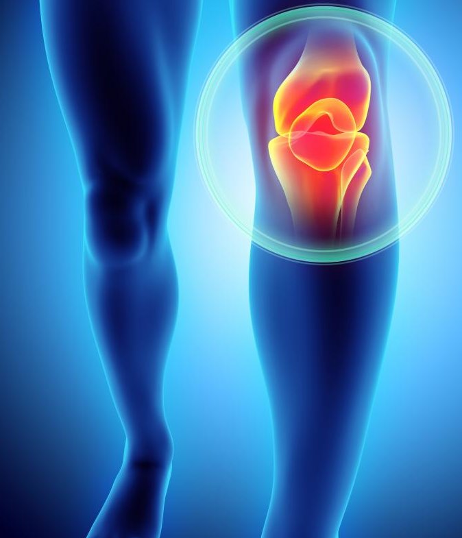 Розрив передньої хрестоподібної зв’язки: що далі? Розрив передньої хрестоподібної зв’язки: що далі?