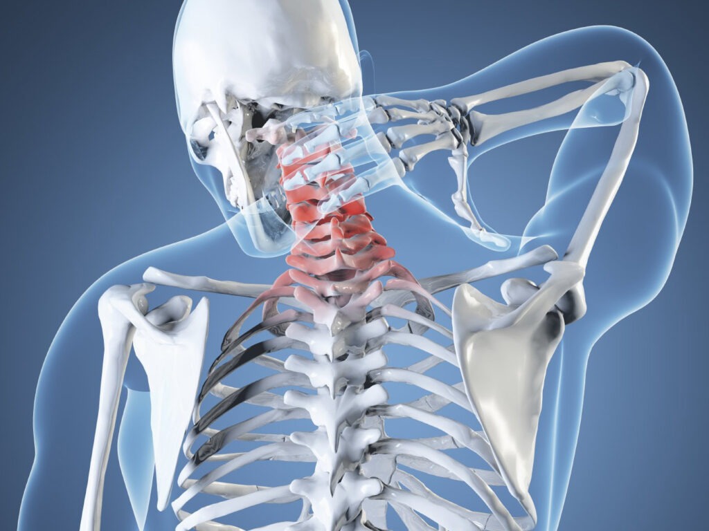      Как диагностируется протрузия и почему она не всегда болит