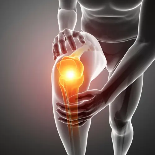    Почему колено «проваливается» — проблема связок или хряща?