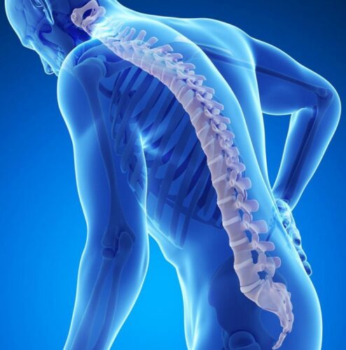       Гиперлордоз: когда изгиб в пояснице слишком сильный