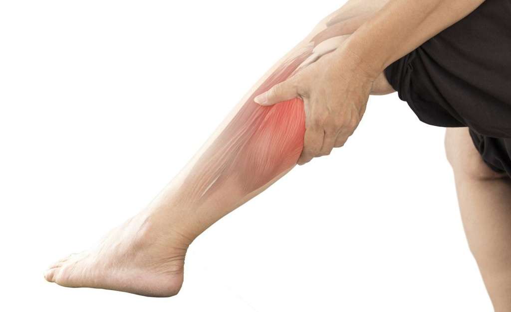  Что такое синдром малоберцового нерва и как он проявляется