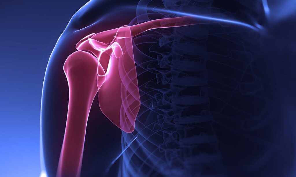     Артроскопия плеча: когда требуется вмешательство