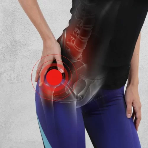 Біль у тазостегновому суглобі: чи це вже артроз?