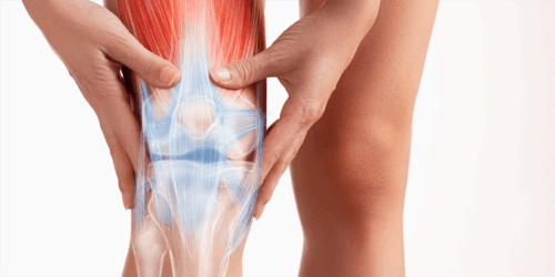     Как травмируются связки без падений — типичные офисные травмы