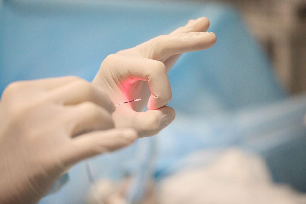 Ендовенозна лазерна коагуляція під контролем УЗД — безпечно і точно