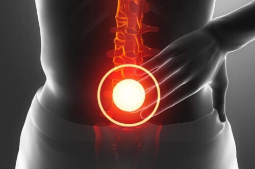 Коли грижа диска ще не потребує операції?