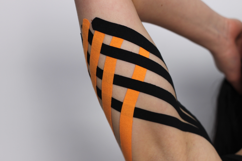 Чи можна використовувати тейпи при варикозі або лімфостазі?