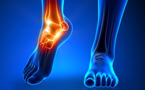 Чому спортивні травми трапляються і в неспортсменів