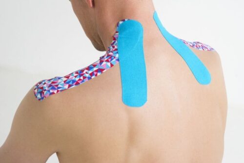 Чи допомагає тейпування при болю в спині або шиї?