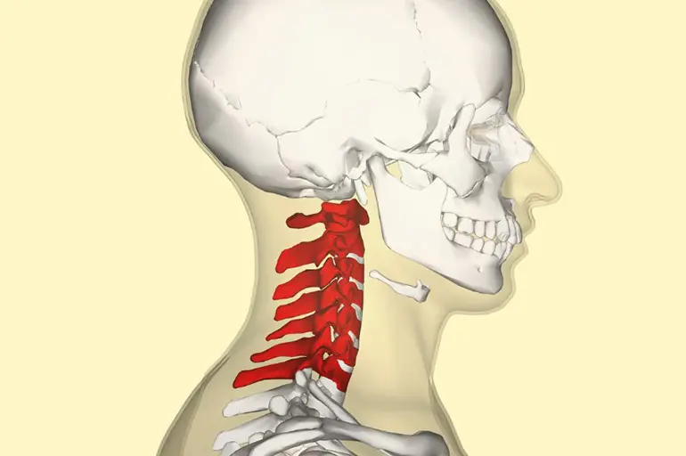 Нестабільність шийного відділу: чому болить і паморочиться?