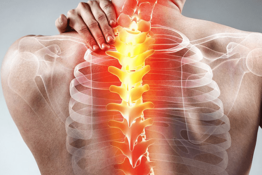 Коли грижа диска ще не потребує операції?