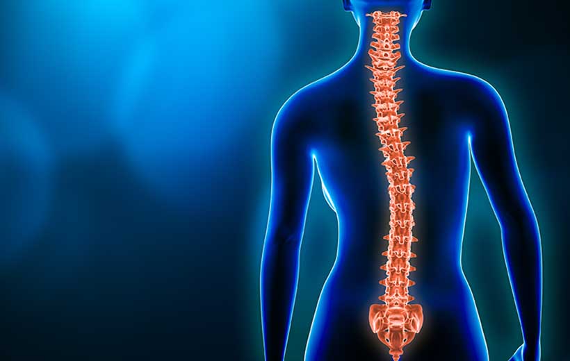 Сколіоз у дорослому віці: з чого почати лікування?