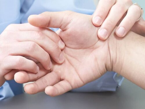 Болить великий палець руки — чи це початок артрозу?