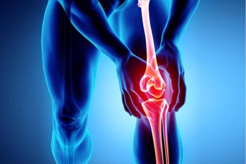 Коли біль у коліні не пов’язаний із травмою: що шукати?