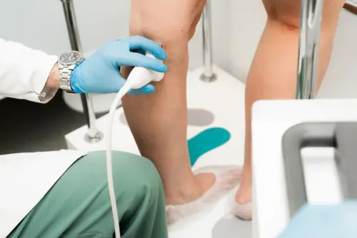 Що таке венозний сканер і навіщо він флебологу?