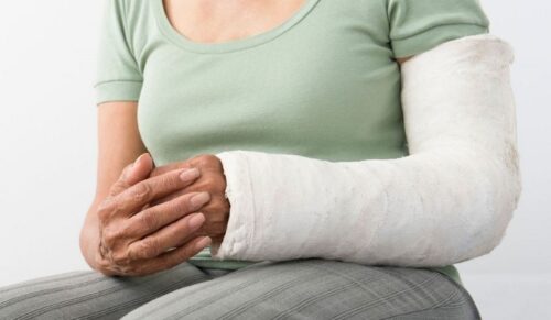 Поколювання в кінцівках після перелому — це нормально?