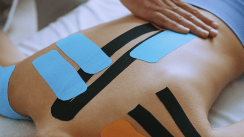 Кінезіотейпування після травм: як і навіщо застосовується?