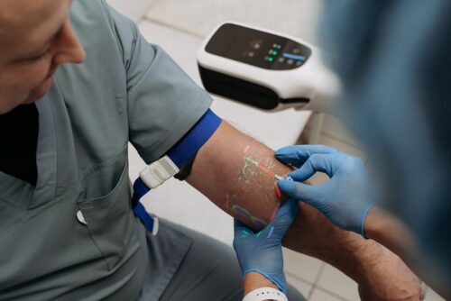 Контроль інʼєкцій за допомогою веносканера: новий стандарт безпеки