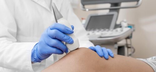 УЗД вен під час консультації судинного хірурга — чи потрібно окремо?