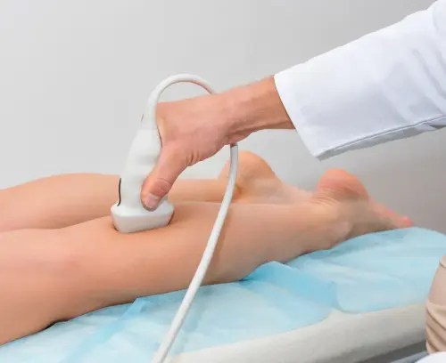 УЗД судин нижніх кінцівок: коли робити навіть без скарг?