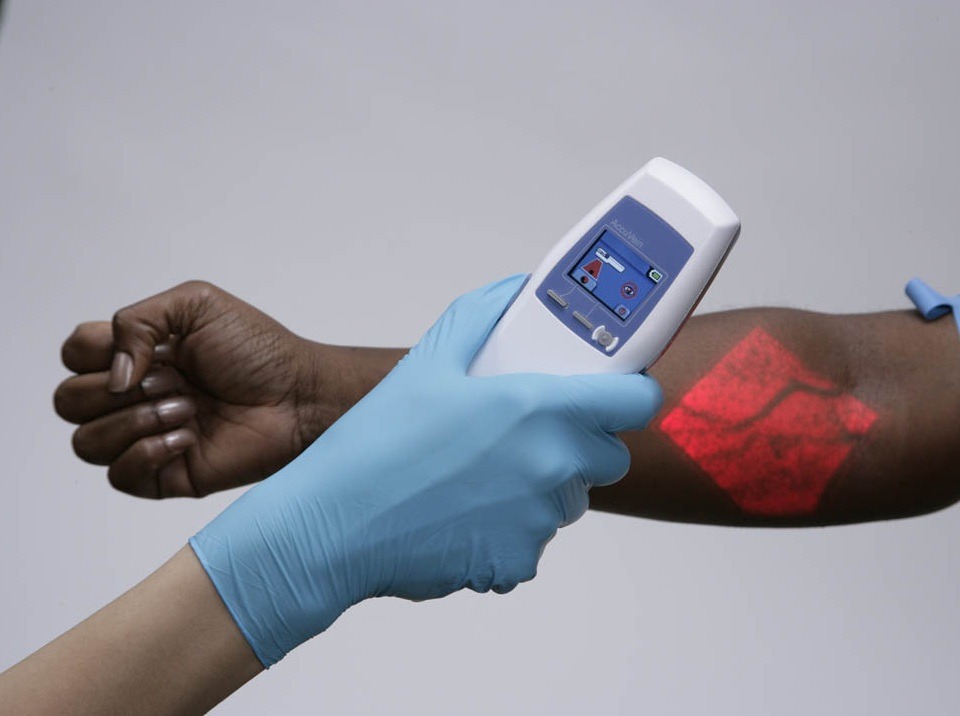 Що бачить венозний сканер, чого не покаже око фахівця?