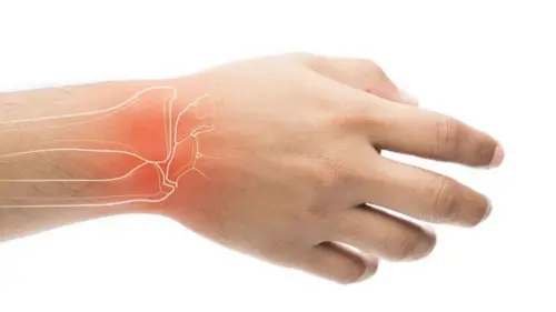 Синдром зап’ястного каналу у вагітних: чому з’являється і як діяти?
