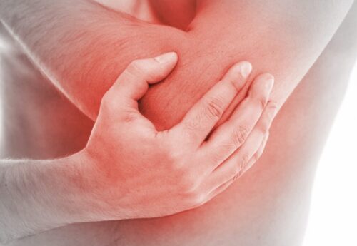 Як реабілітувати кисть після защемлення променевого нерва?