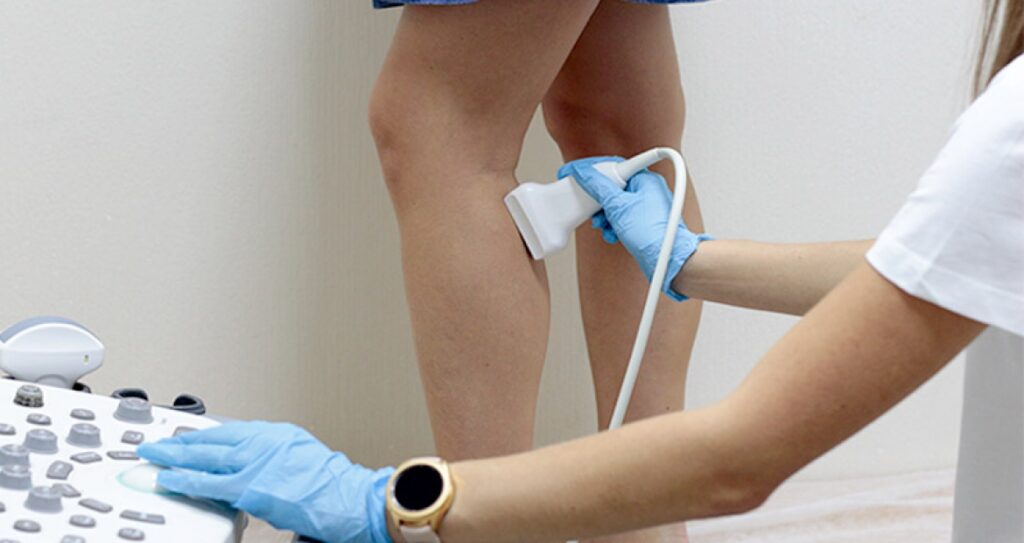 Як виглядає консультація флеболога з УЗД одразу на прийомі?