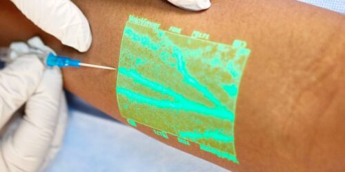 Що бачить венозний сканер, чого не покаже око фахівця?