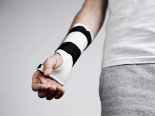 Повернення сили руки після тунельного синдрому — етапи реабілітації