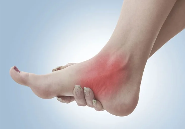 Лікування нейропатії після розтягнення або вивиху