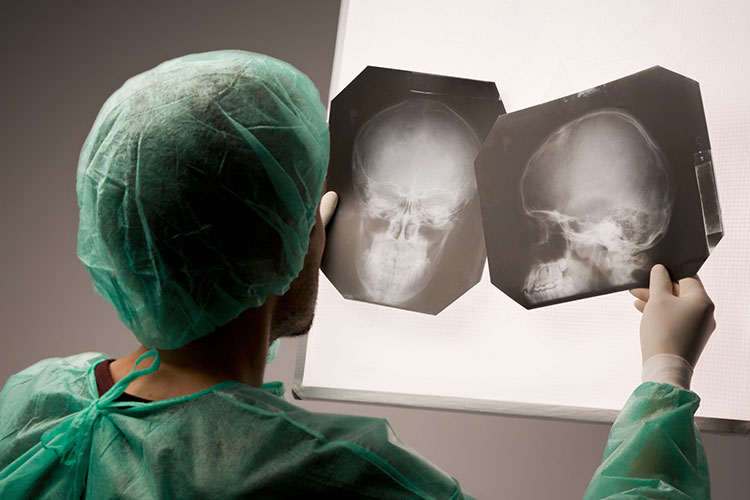 Як впливає реабілітація на емоційний стан після ЧМТ?