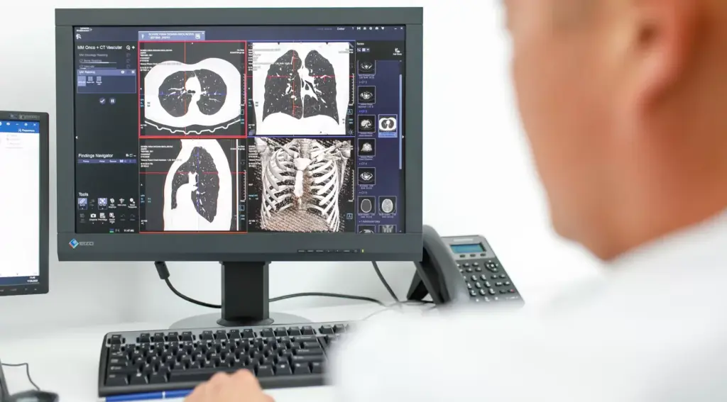 УЗД при болю в литках: чим відрізняється від МРТ?