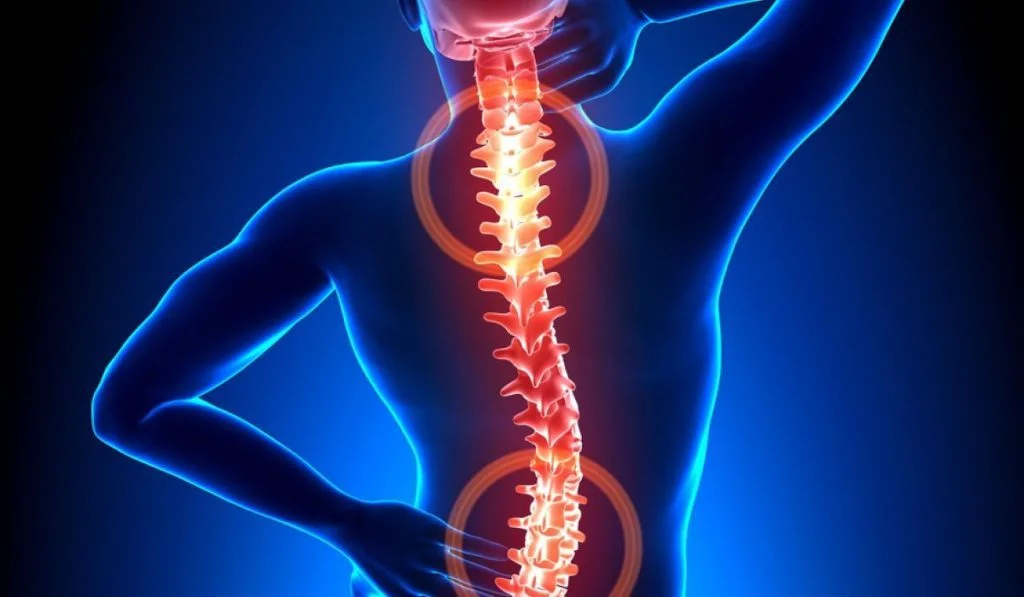 Остеохондроз: чому виникає біль у хребті?